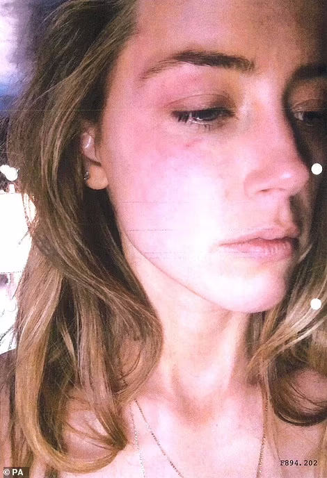 31012258-10716531-Another_photo_shown_to_court_shows_a_mark_below_her_eye_in_an_al-a-19_1649880952876