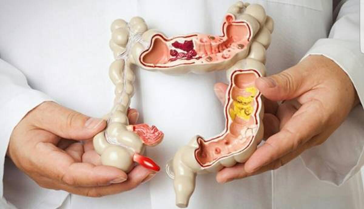 روشی ساده و آسان برای پاکسازی روده در خانه